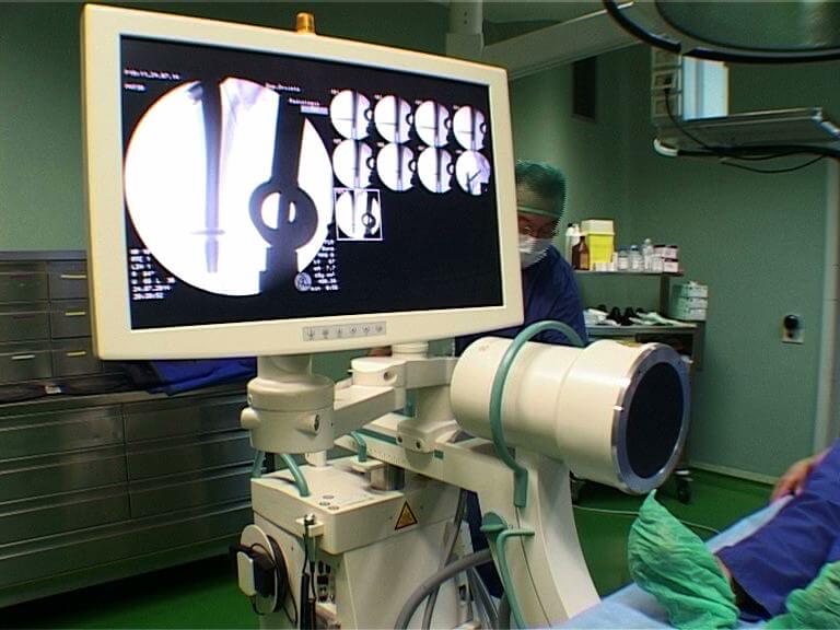 NUOVE APPARECCHIATURE TERAPIE INTENSIVE: TEMPISTICHE PREOCCUPANTI  