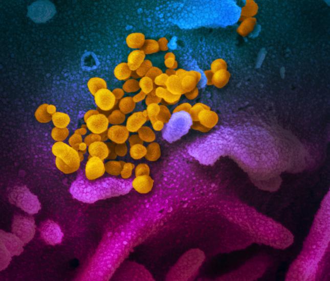 CORONAVIRUS: NUOVA RIUNIONE TASK FORCE REGIONALE DÀ INDICAZIONI AI SINDACI UMBRI