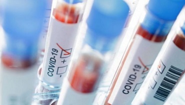 CORONAVIRUS: 164 I POSITIVI IN UMBRIA, 420 FUORI DALL’ISOLAMENTO FIDUCIARIO