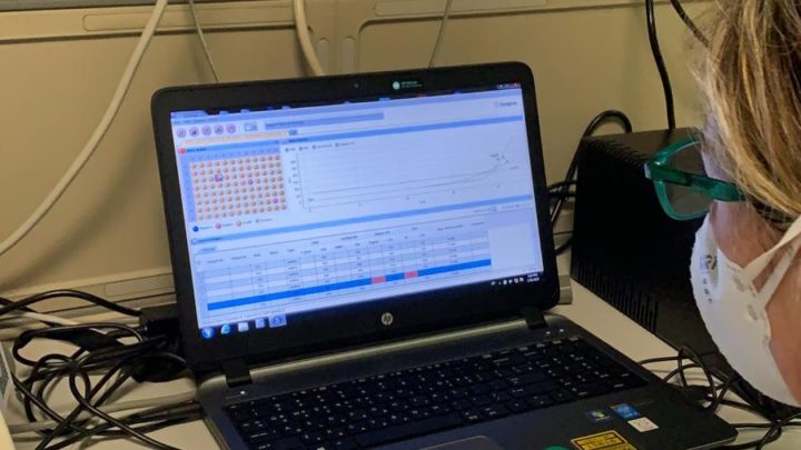 CORONAVIRUS: AL VIA RICERCA POSITIVITÀ CON TEST RAPIDI
