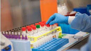 CORONAVIRUS: IN UMBRIA 2 DECEDUTI, 247 POSITIVI, 648 FUORI DA ISOLAMENTO FIDUCIARIO
