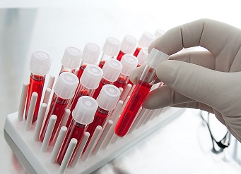 CORONAVIRUS: SONO 32 I RESIDENTI DEL COMUNE DI ORVIETO CONTAGIATI DAL COVID-19