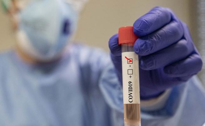 CORONAVIRUS: ALTRI 10 RESIDENTI GUARITI DAL COVID-19, PER 5 DI LORO REVOCATO ISOLAMENTO CONTUMACIALE
