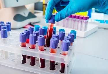 CORONAVIRUS: EMESSE OGGI 5 ORDINANZE CONTUMACIALI PER RESIDENTI DI ORVIETO RISULTATI POSITIVI AL COVID-19