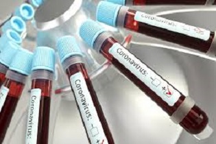 CORONAVIRUS: IN UMBRIA 522 I POSITIVI, 1578 FUORI DALL’ISOLAMENTO FIDUCIARIO, DATI AGGIORNATI ALLE ORE 8 DEL 22 MARZO