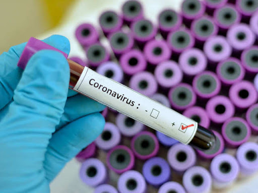 CORONAVIRUS: AGGIORNAMENTO CASI ALLE ORE 8 DEL 17 APRILE