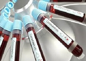 CORONAVIRUS: AGGIORNAMENTO CASI ALLE ORE 8 DI SABATO 18 APRILE