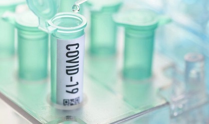 CORONAVIRUS: I DATI SULL’ANDAMENTO DELL’EMERGENZA SANITARIA A LIVELLO REGIONALE FORNITI SU NUOVA DASHBOARD DEL PORTALE DELLA REGIONE