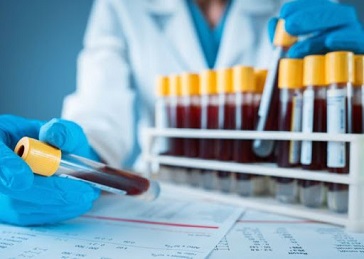 COVID, PROVVEDIMENTI COMUNI PER CONTENERE CONTAGIO