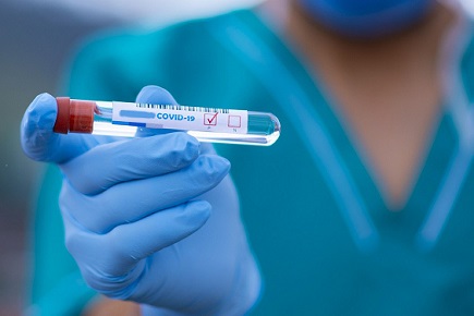 CORONAVIRUS: DA ISS RISCONTRATI DUE CASI SOSPETTI DI VARIANTE BRASILIANA SARS-COV-2 SU CAMPIONI INVIATI DALL’UMBRIA