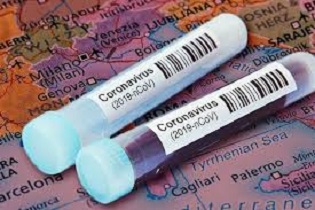 CORONAVIRUS: ANDAMENTO EPIDEMIA DAL 15 AL 22 OTTOBRE