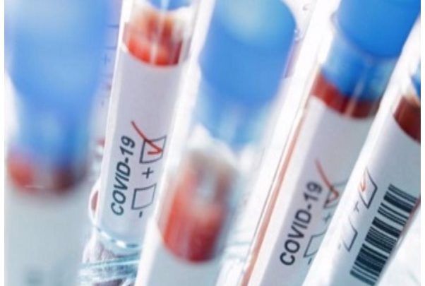CORONAVIRUS: SINDACO HA EMESSO 26 ORDINANZE DI ISOLAMENTO DOMICILIARE PER RESIDENTI AD ORVIETO POSITIVI AL COVID-19