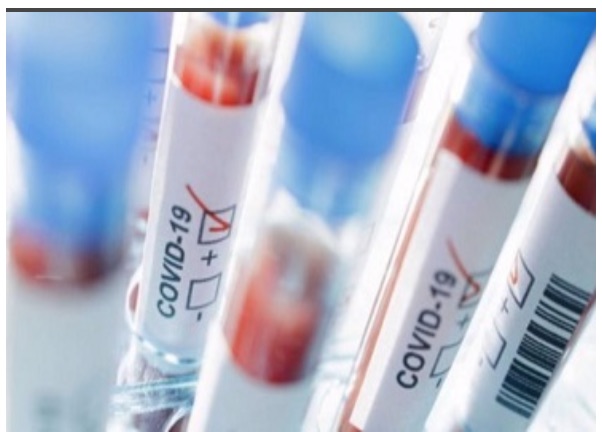 CORONAVIRUS: IN UMBRIA CONTAGI “ZERO”; AGGIORNAMENTO CASI ALLE ORE 8 DEL 3 MAGGIO