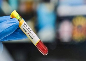CORONAVIRUS: ISOLAMENTO PER TRE RESIDENTI NEL COMUNE DI ORVIETO POSITIVI AL COVID-19