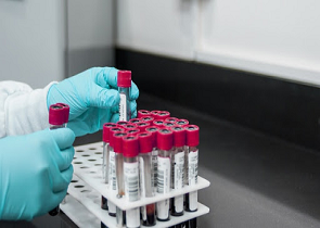 CORONAVIRUS: ANDAMENTO SETTIMANALE 12-19 GIUGNO