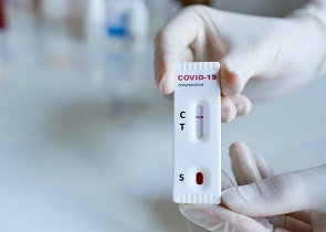 CORONAVIRUS, SCREENING SIEROLOGICO PER IL PERSONALE SCOLASTICO: COLETTO, “LA GRANDE ADESIONE E I RISULTATI LASCIANO SPERARE IN UNA RIPARTENZA DELLA SCUOLA IN TRANQUILLITÀ”