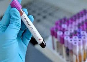 CORONAVIRUS: RIUNITO CTS, AL MOMENTO IDONEE LE MISURE ADOTTATE DAI SINDACI