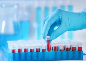 DOMENICA 2 AGOSTO APERTI CENTRI PRELIEVO SANGUE DI TERNI, FOLIGNO E CITTÀ DI CASTELLO