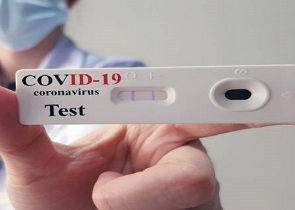 CORONAVIRUS: APPROVATO ACCORDO CON LE FARMACIE PER TEST AL PERSONALE SCOLASTICO, ASSESSORATO ALL’ISTRUZIONE STANZIA 1 MILIONE DI EURO
